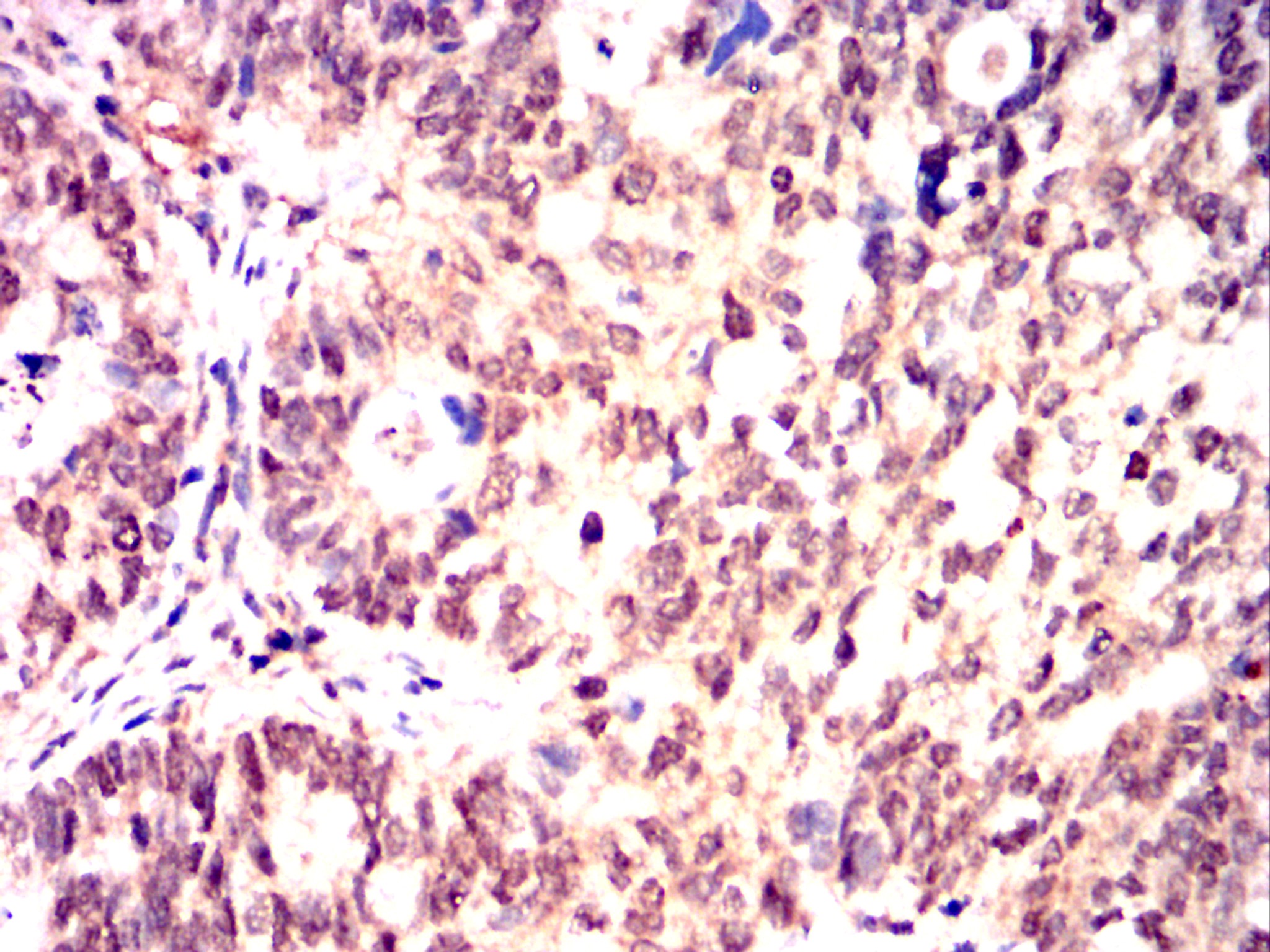 		IHC